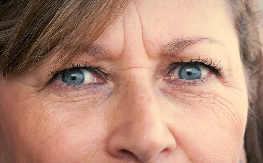 🅰️Морщина и залом. В чем разница. И как убрать.