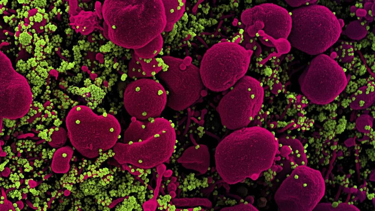 © AFP 2024 / NATIONAL INSTITUTE OF ALLERGY AND INFECTIOUS DISEASES 