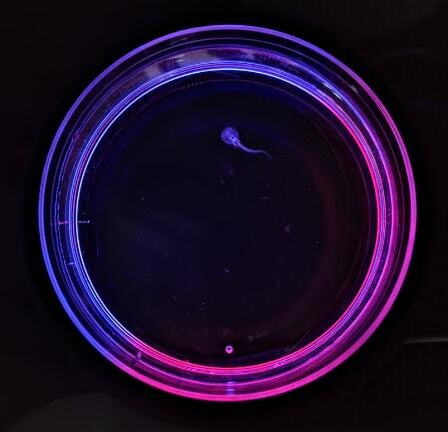 Головастики лягушек вида Xenopus laevis — хорошая модель для нейробиологии человека, поскольку их легко выращивать в больших количествах, при этом легко наблюдать за изменениями в их поведении и фиксировать их. Изображение: Unravel Biosciences