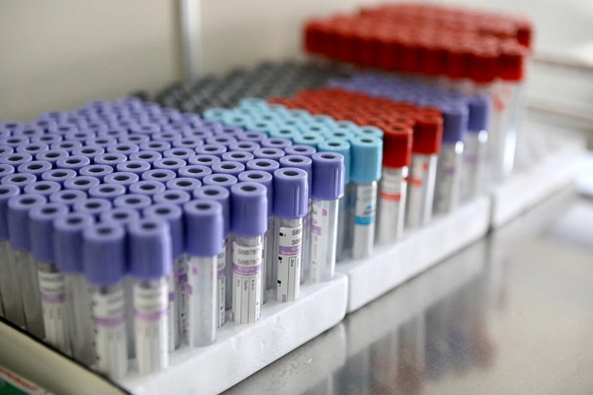    Заболеваемость ковидом выросла во Владимирской области