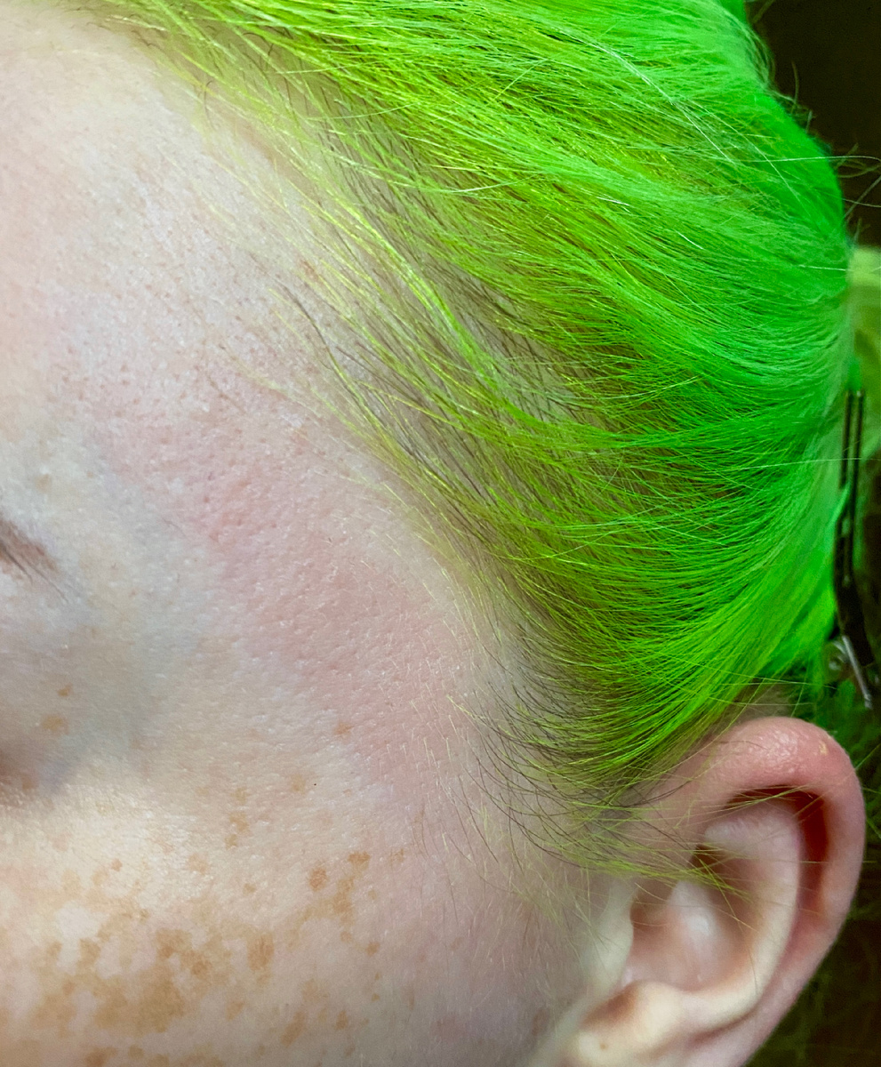 Так выглядела кожа с утра