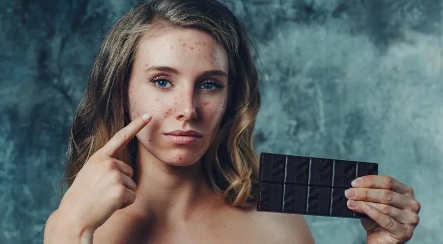 Противовоспалительная диета: что можно есть, а какие продукты под запретом — читать на Gastronom.ru