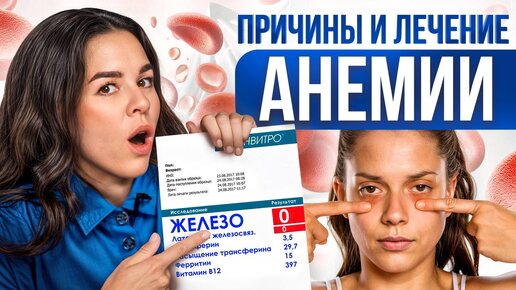 Как понять, что у тебя железодефицит ТОП 10 важных продуктов в рационе при анемии (ПРИЧИНЫ И ЛЕЧЕНИЕ АНЕМИИ)