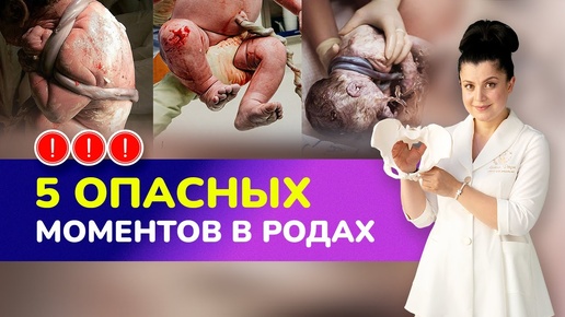 ⚠️5 опасных моментов в родах I Какие осложнения могут возникнуть во время родов?