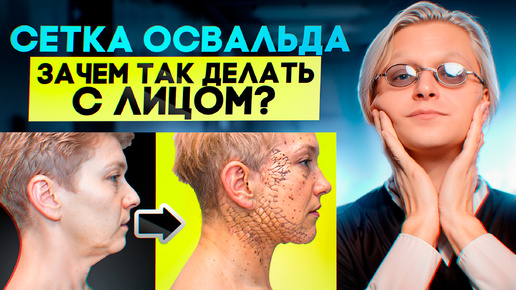 Зачем хирурги штопают лицо? Сетка Освальда