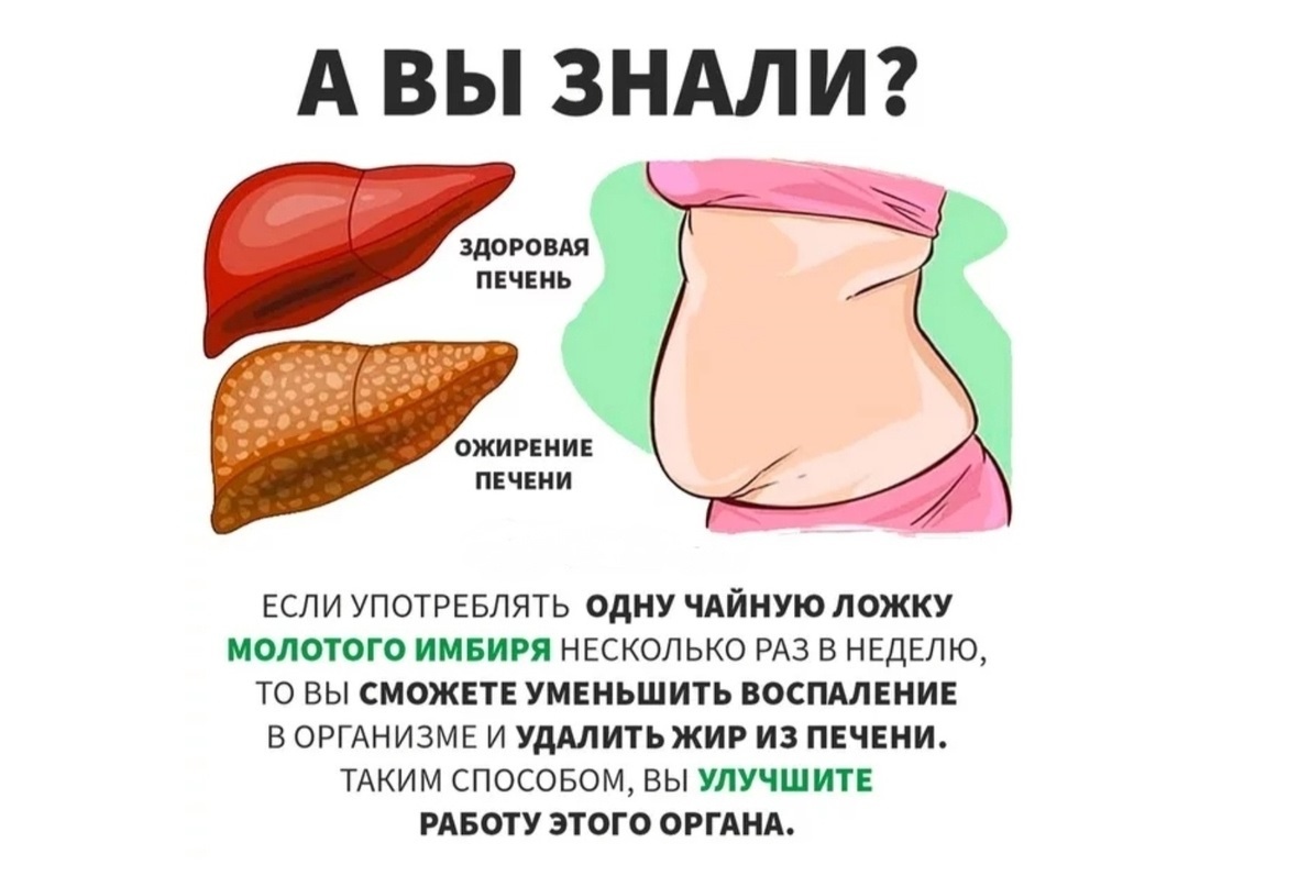 Ожирение печени у женщин после 60. Жировой гепатоз 1 степени. Ожирение печени у женщин после 60. Как выглядит ожирение печени у женщин. Гепатоз ожирение печени.