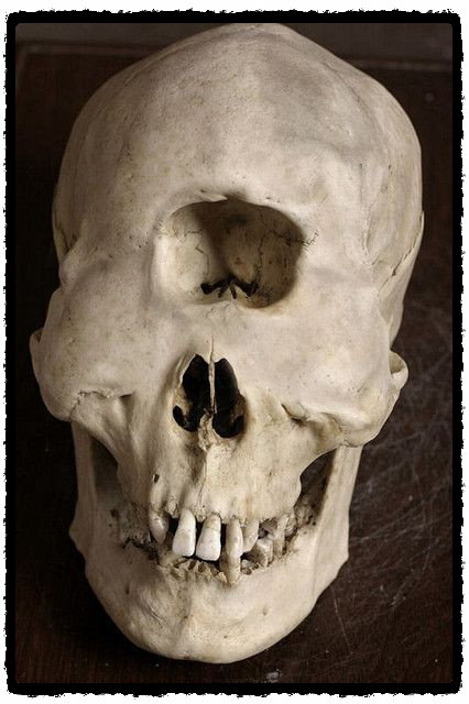 Череп циклопа