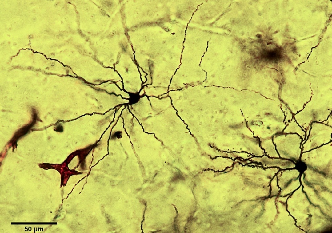 Окраска нервной ткани (метод серебрения по Гольджи)