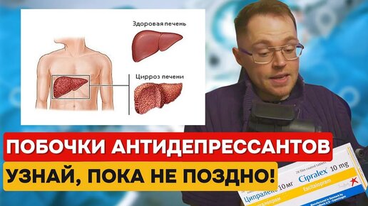 ПОБОЧНЫЕ ЭФФЕКТЫ АНТИДЕПРЕССАНТОВ | Что с СЕРДЦЕМ, ПЕЧЕНЬЮ и ПОЧКАМИ? Повышение ПРОЛАКТИНА?