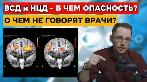 Download Video: Что такое ВСД и НЕЙРОЦИРКУЛЯТОРНАЯ ДИСТОНИЯ?