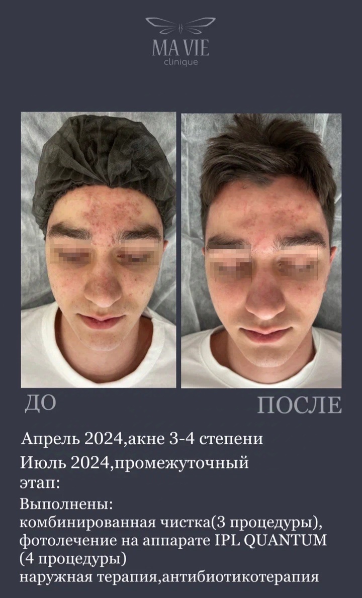 Процесс лечения продолжается. Очень сложный и многоэтапный. 