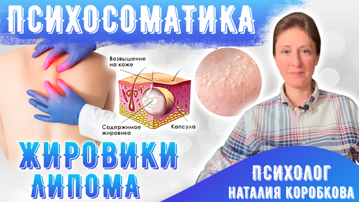 Жировики Липома Психосоматика