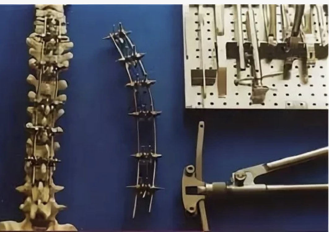 Она навсегда. Ставится людям взрослым, у которых рост остановился.