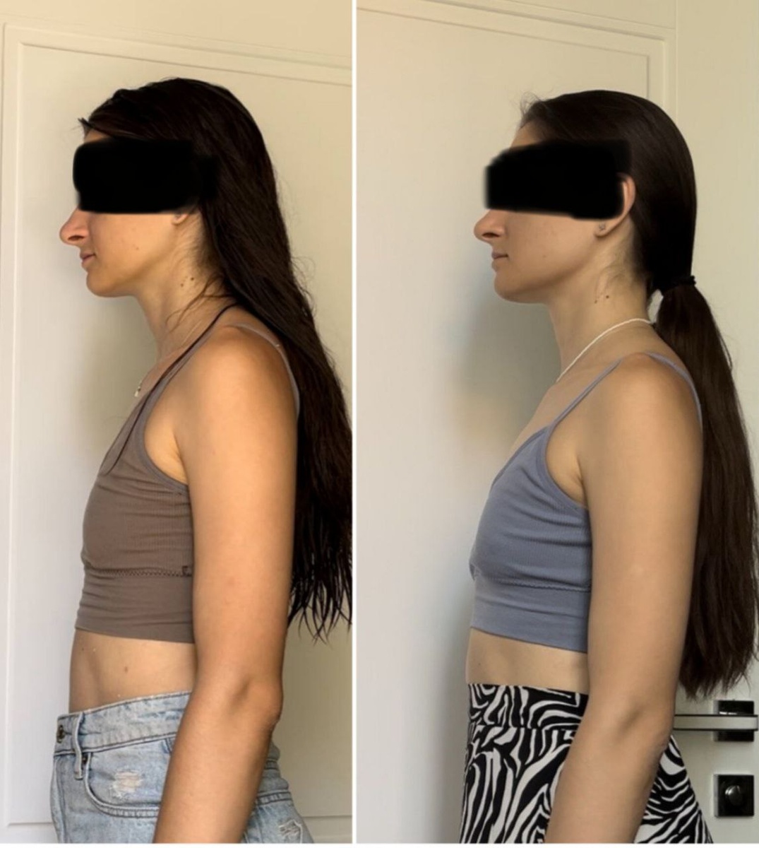 слева Катя ДО, справа ПОСЛЕ