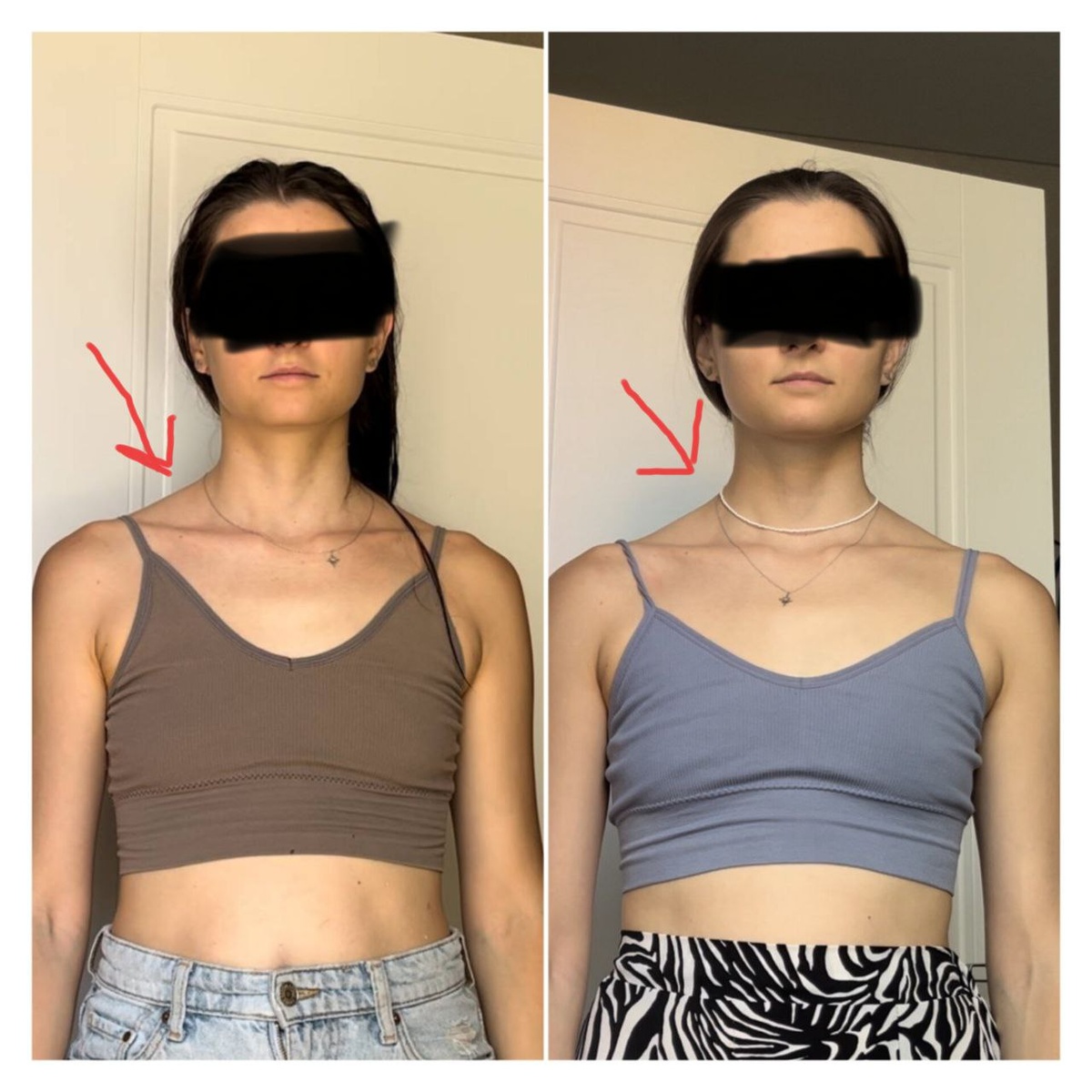 изначально нарушенная постура