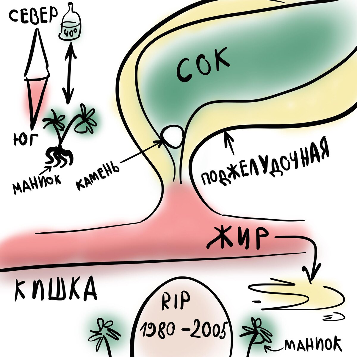 Тропический панкреатит