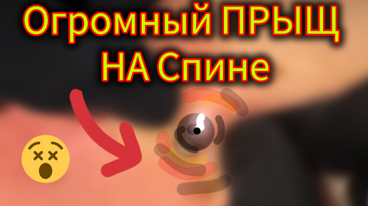 Download Video: У Косметолога Устали Пальцы Давить Его.