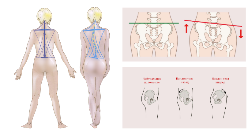 Когда стоя ровно чаще всего переносите центр тяжести на одну и ту же ногу, это может быть признаком перекоса таза и поводом провериться у специалиста кинезиолога для коррекции