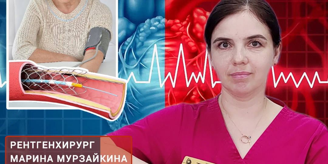 Как влияет стентирование на кровяное давление. Объясняет рентгенхирург Марина МУРЗАЙКИНА