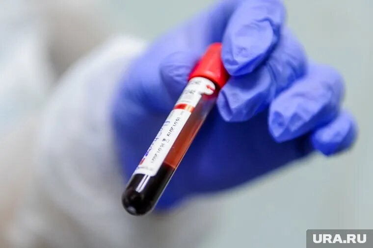 Четверо детей умерли от пельменей. Четверо детей умерли от пельменей. Четверо детей умерли от пельменей. Четверо детей умерли от пельменей. Четверо детей умерли от пельменей.
