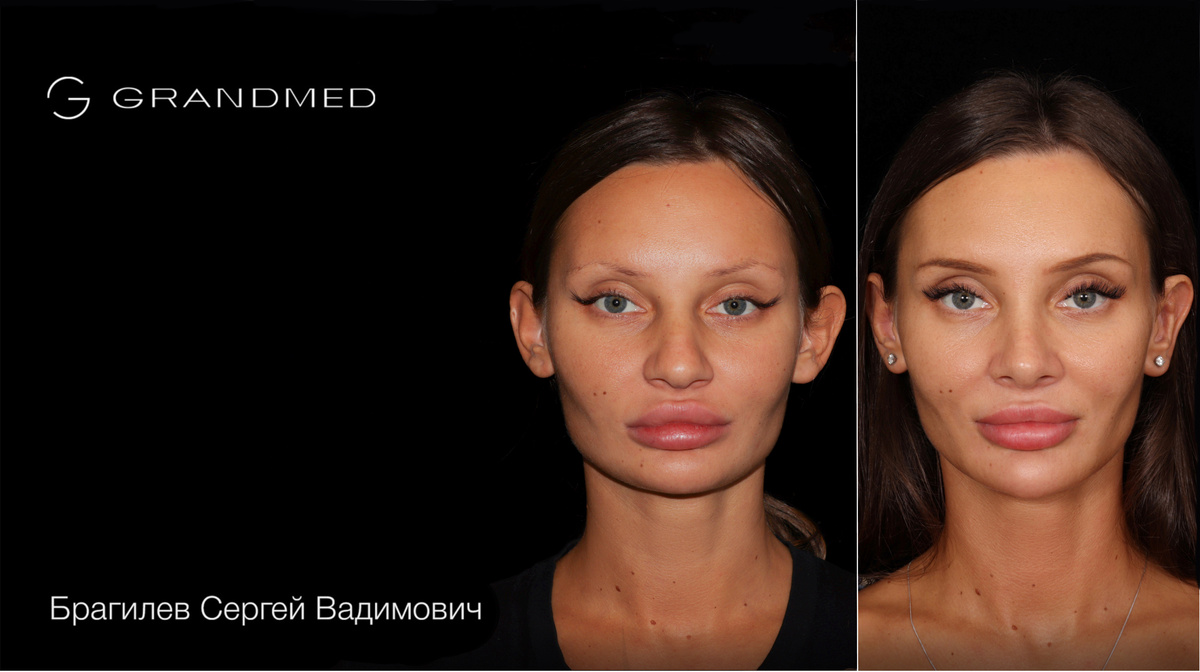 telegram-канал хирурга @sbragilev