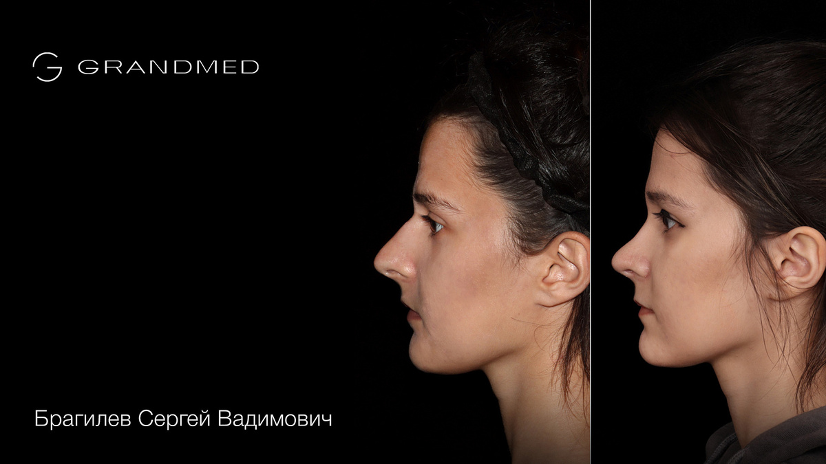 telegram-канал хирурга @sbragilev