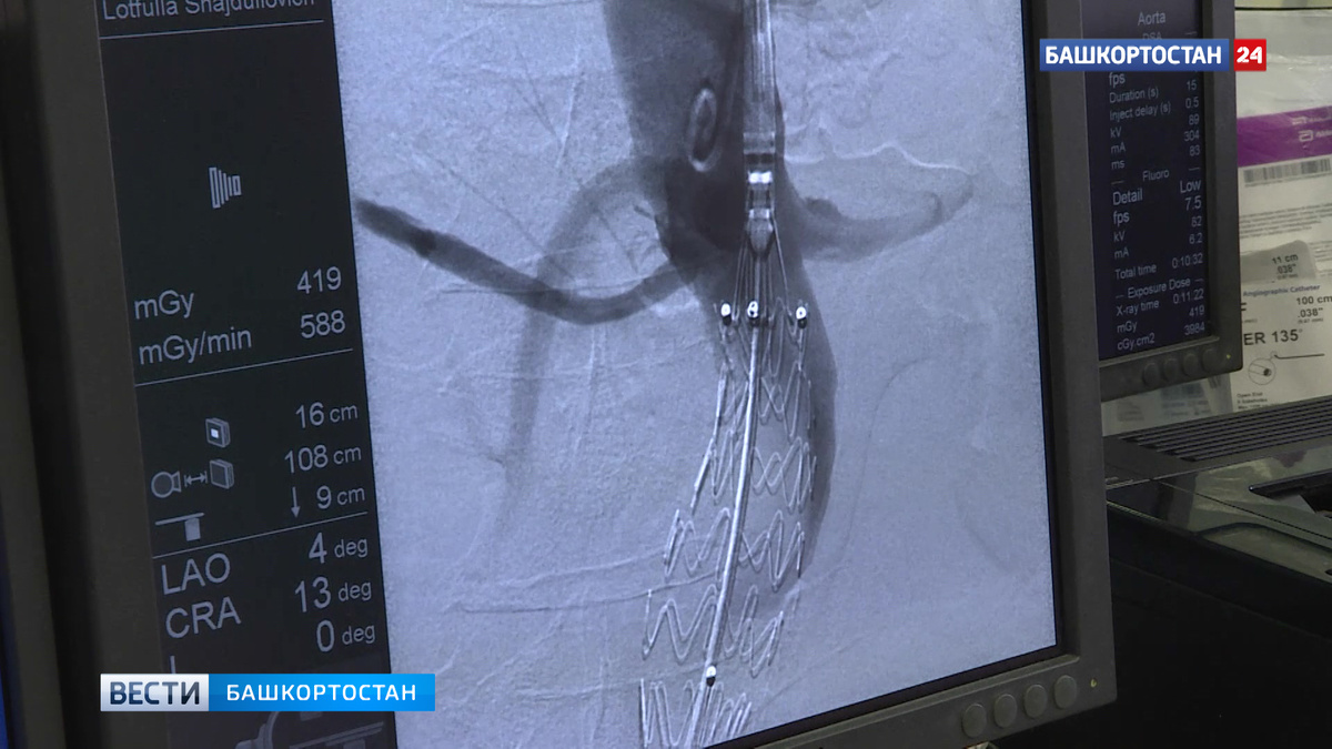    В Республиканской клинической больнице им. Куватова активно используется новый электрокоагулятор