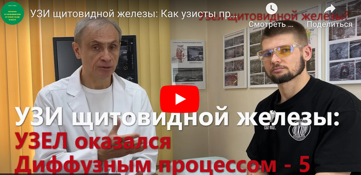 Узел щитовидной железы