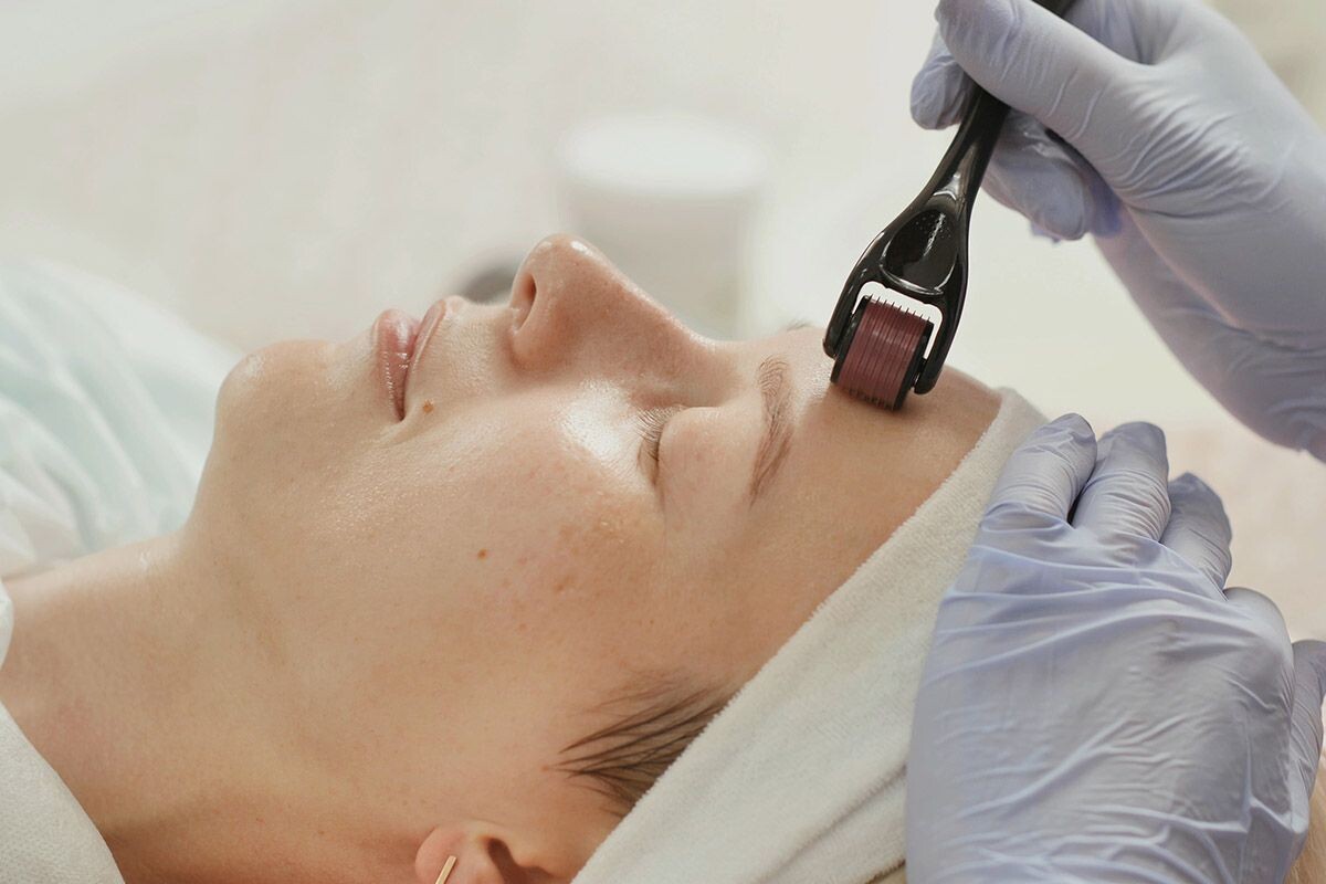 Во время процедуры могут быть легкие покалывания, но в идеале не должно быть никаких болевых ощущений. Источник: Shutterstock📷
