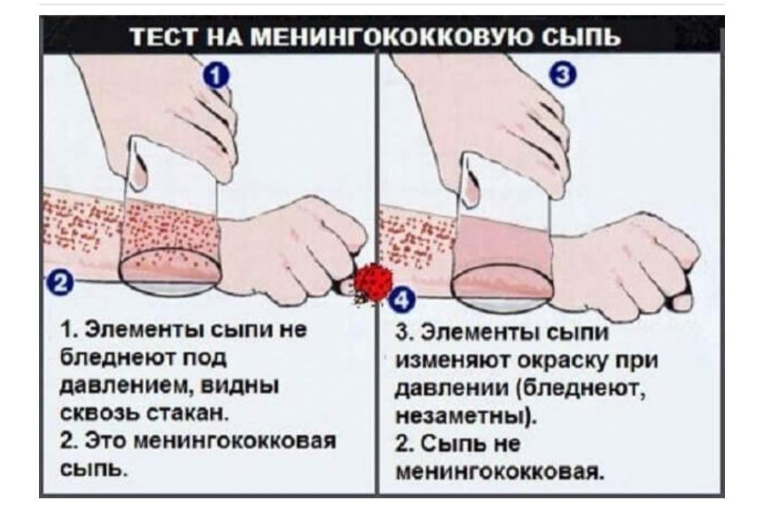 Проба со стаканом 
