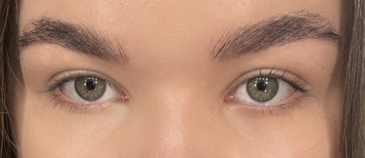 Посмотрите наглядную разницу, как хорошо консилер освежает взгляд и перекрывает синячки