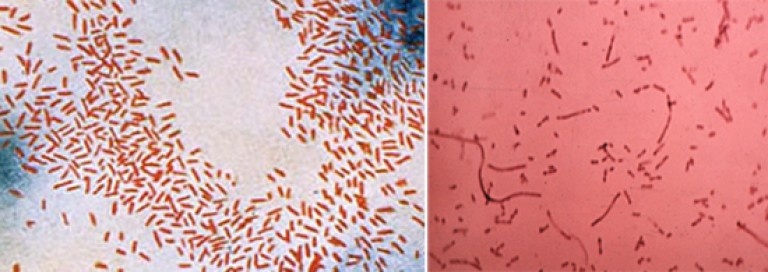 Тут один вид микробов, два или три? На самом деле только один.