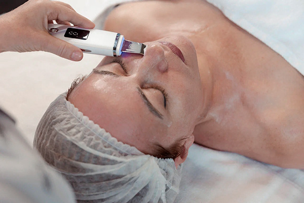 NOVAPEEL [AHA] - инновационный пилинг экспертного уровня