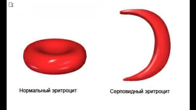 Вот такая разница примерно.