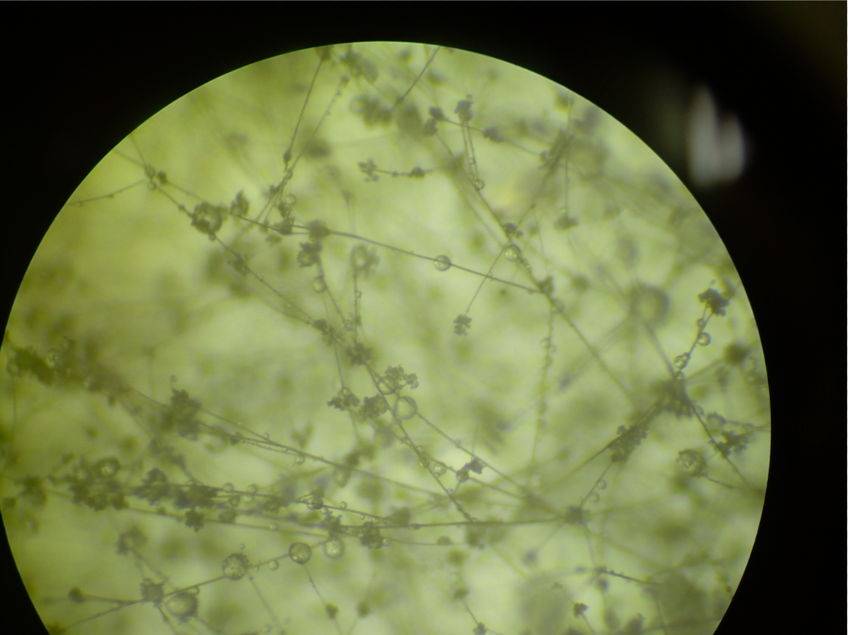 Возбудитель серой гнили, гриб Botrytis cinerea. Увеличение 4,5×
