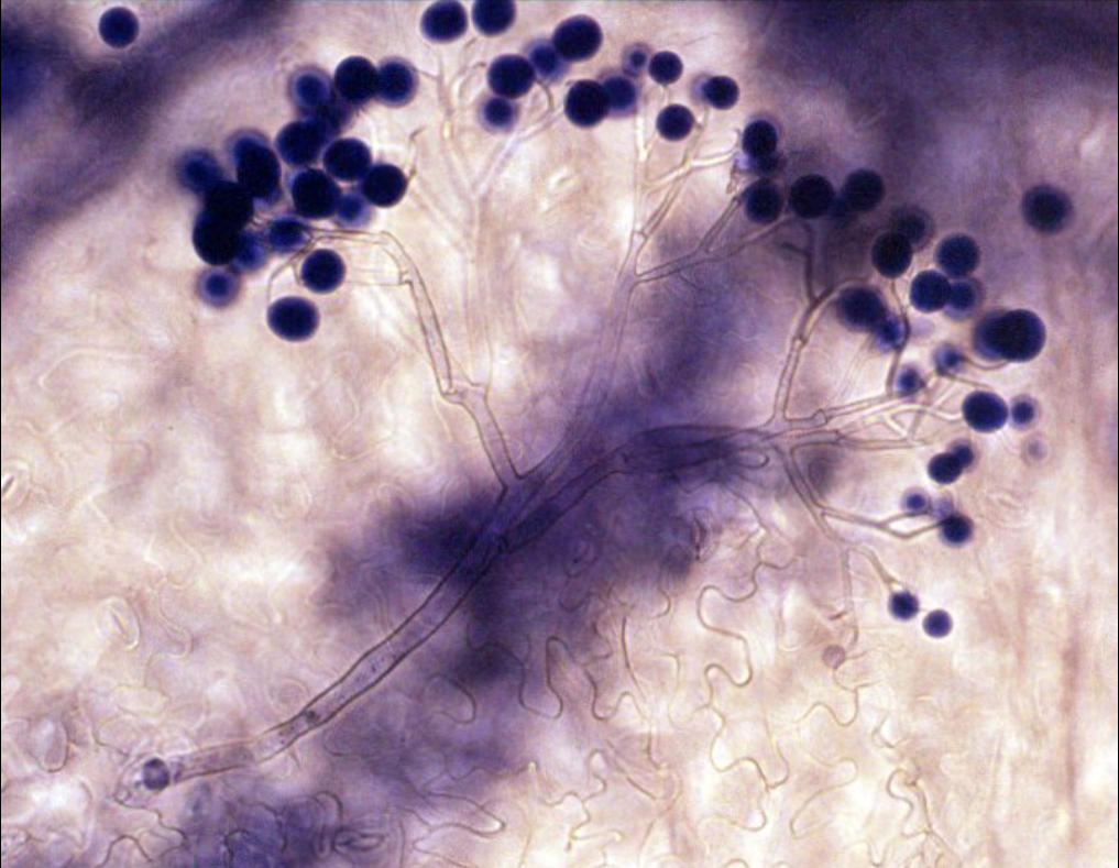 Конидиеносец вида Hyaloperonospora parasitica с несколькими конидиями