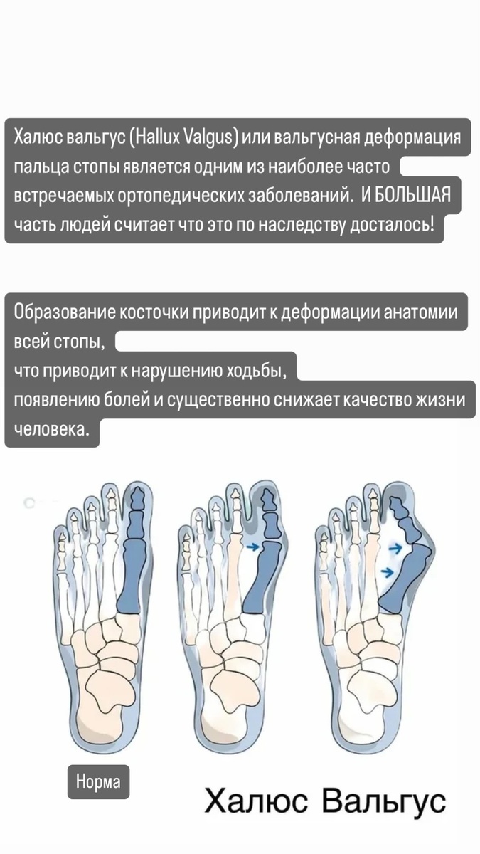 Самое главное понять, что это не так же как у мамы/бабушки, это можно исправить и вообще до этого лучше не доводить!