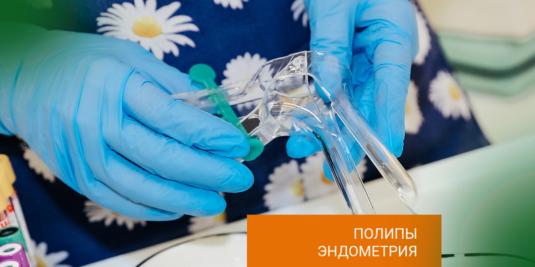 ПОЛИПЫ ЭНДОМЕТРИЯ