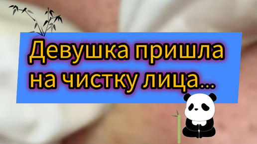 Выдавливание/Чистка Лица от ПРЫЩЕЙ. Косметолог расслаблен и нетороплив.