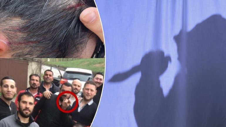    Турецкие фанаты с ножами совершили нападение на армянских футболистов.соцсети Global Look Press