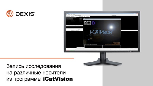 Запись исследования на различные носители из программы iCatVision