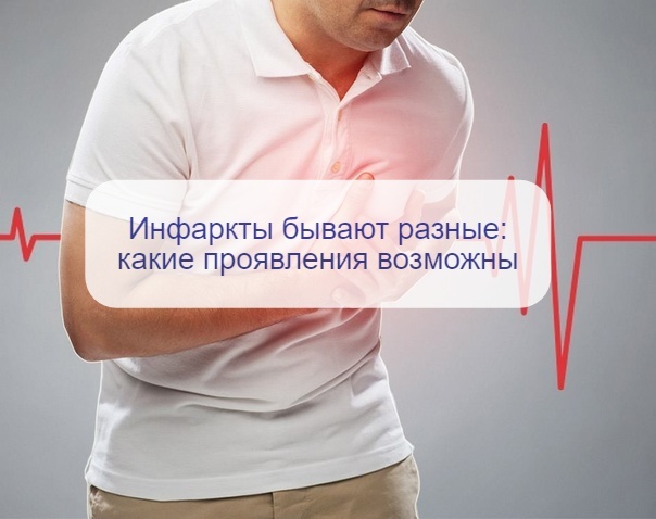Инфаркт у всех разный: патофизиолог назвала 5 вариантов с совершенно разными симптомами