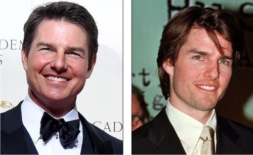 Том Круз до и после пластики