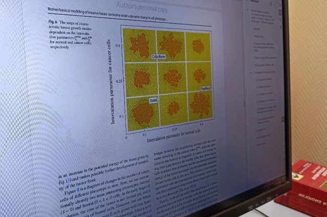    Пермские учёные исследовали, как раковые клетки перерождаются и проникают в здоровые ткани. Фото:  АиФ/ Ирина Вервильская