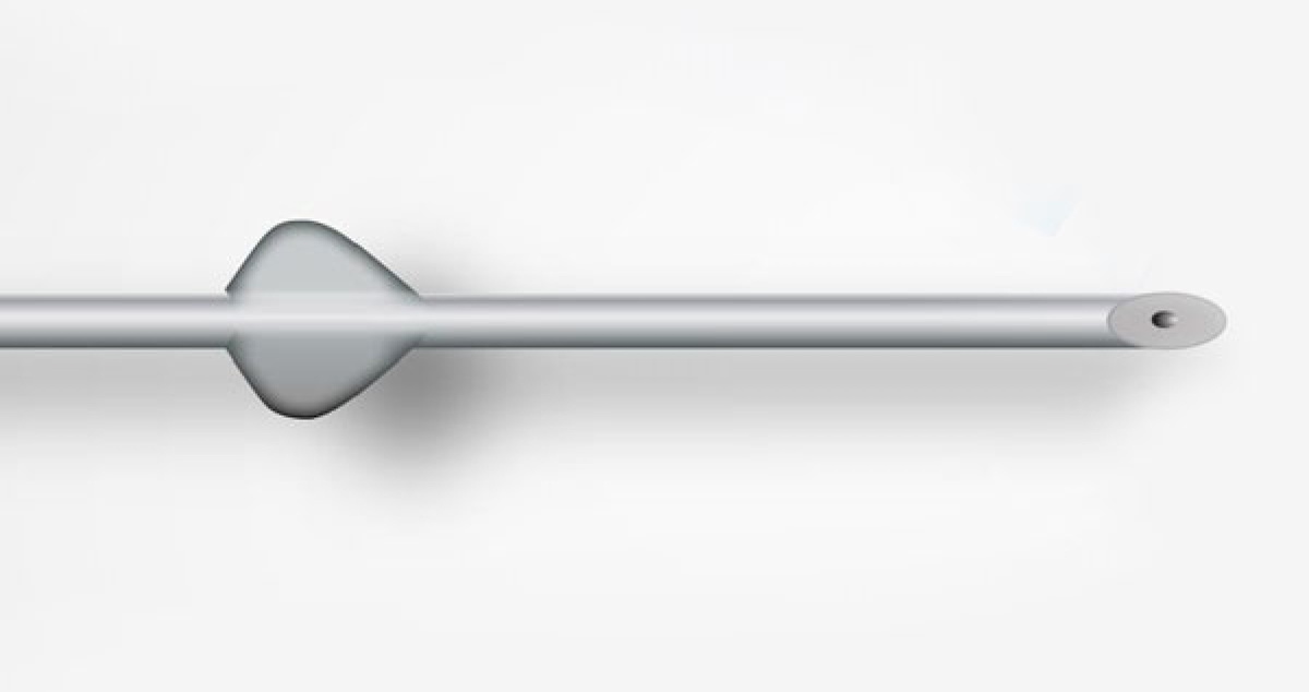 Микрошунт PreserFlo - инновационное устройство для лечения глаукомы