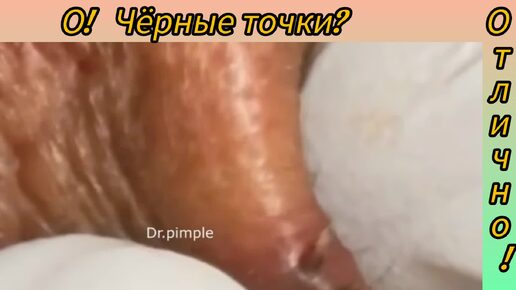 Download Video: Какие чудесные чёрные точки!