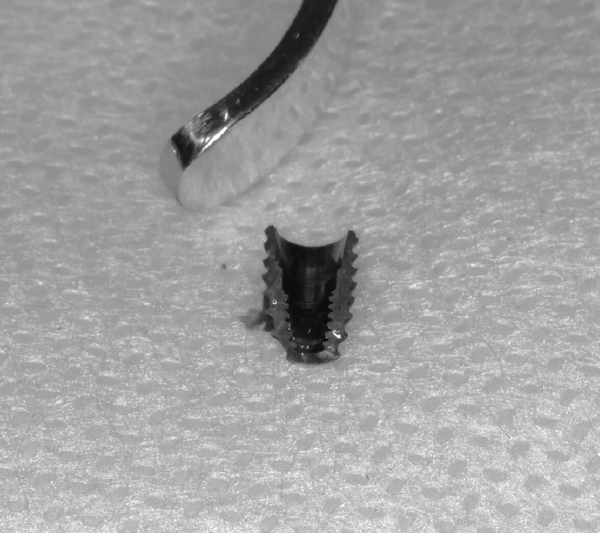 Сломался имплантат 