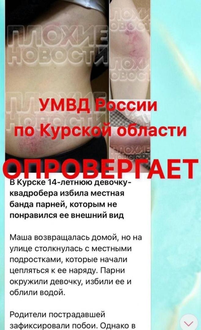    В Интернете активно распространяется фейк об избиении в Курской области девочки-квадробера