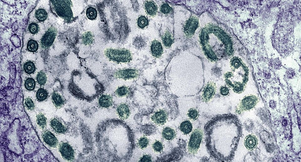    IMAGO/CDC / IMAGE POINT FR / BSI / Global Look Press