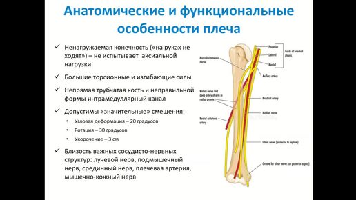 Лечение переломов диафиза плечевой кости – современные подходы.